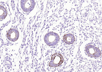 Pan Cytokeratin Antibody