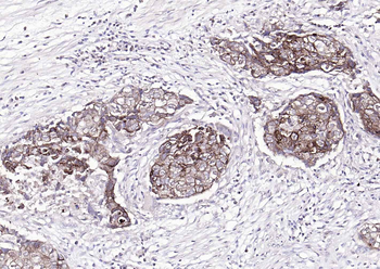 Pan Cytokeratin Antibody