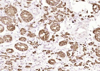 Pan Cytokeratin Antibody