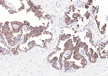 Pan Cytokeratin Antibody