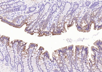 Pan Cytokeratin Antibody