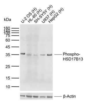Phospho-HSD17B13 (Ser33) Antibody