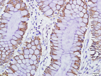 GPCR EX33 antibody