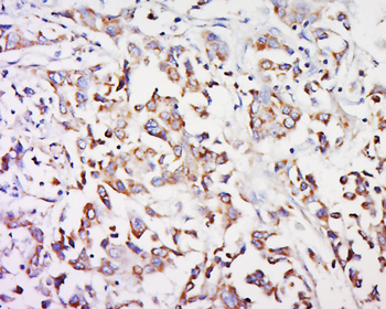 GPR91 antibody