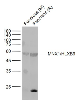 HB9 antibody