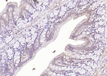 HDAC3 antibody