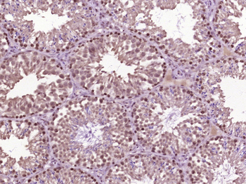 HSP70 antibody