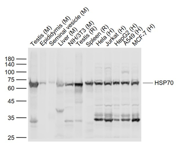 HSP70 antibody