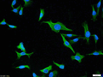 HSP70 antibody