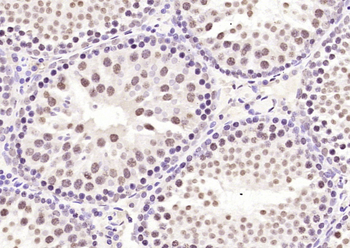 LMX1b antibody