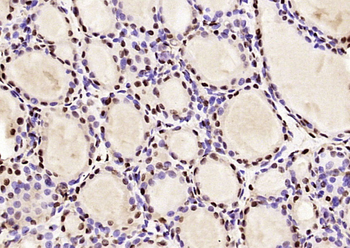 LMX1b antibody