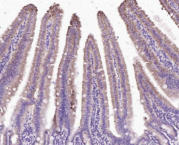 MAOB antibody