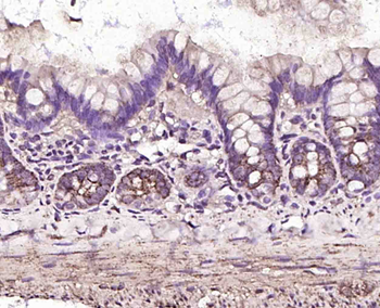 MAOB antibody