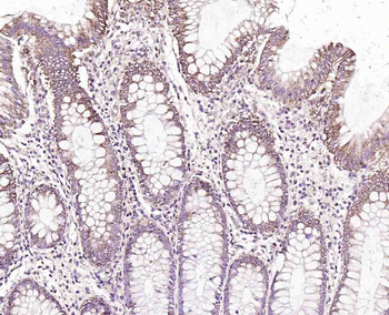 MAOB antibody