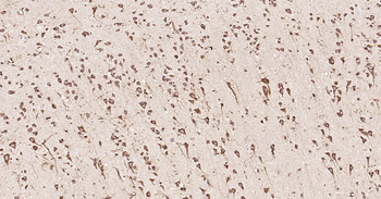 Calreticulin Antibody