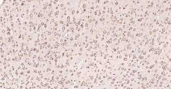 Calreticulin Antibody