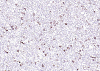 SOX4 antibody