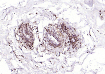 SOX4 antibody