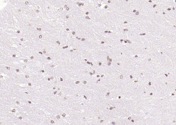 SOX4 antibody