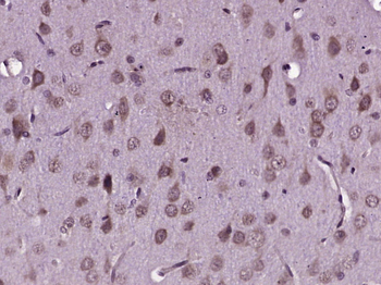 Spinophilin antibody