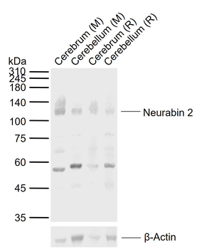 Spinophilin antibody