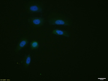 STAT1 p84+p91 antibody