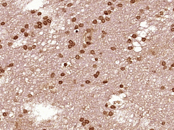 STAT1 p84+p91 antibody