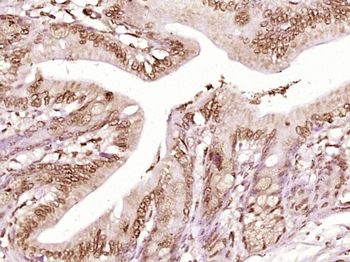 STAT1 p84+p91 antibody