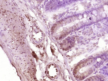 STAT1 p84+p91 antibody