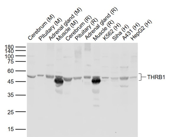 THRB1 antibody