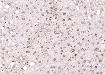 THRB1 antibody