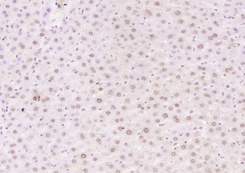 THRB1 antibody