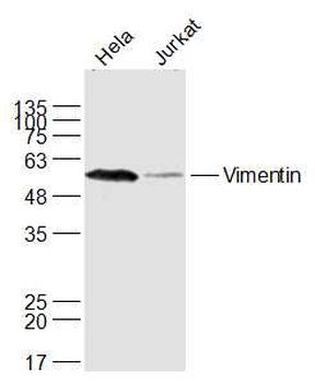 Vimentin antibody