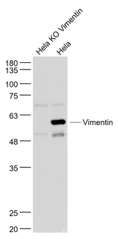 Vimentin antibody