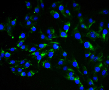 Vimentin antibody