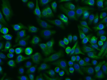 Vimentin antibody