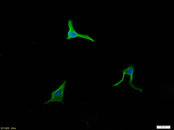 Vimentin antibody