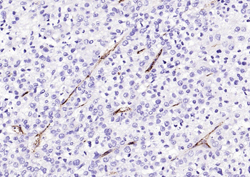 vWF antibody