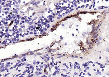 vWF antibody