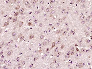 vWF antibody