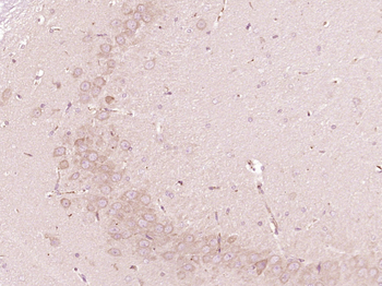 vWF antibody