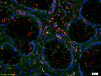 vWF antibody