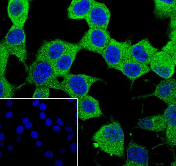 STIP1 Antibody