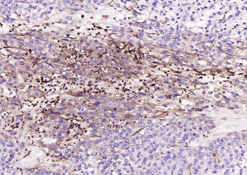 HLA-C Antibody