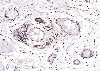 HLA-C Antibody