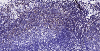 HLA-C Antibody