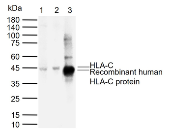 HLA-C Mouse Monoclonal Antibody