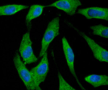 Ferritin Heavy Chain Antibody