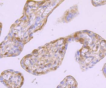 Ferritin Heavy Chain Antibody