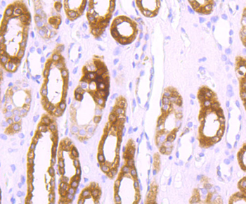 Ferritin Heavy Chain Antibody